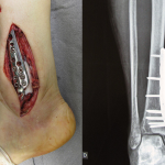 801a089759389ea9fa5f77ecc339f4be 2