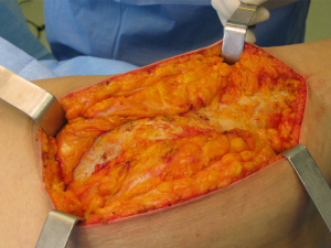 722fd8c97825bdea860322e28ac6dcbd 3