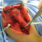 Ac2ef27277eab81da1d8dea067dd80c1 3