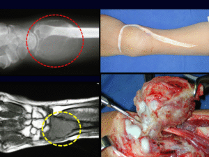 Reconstruções Ósseas Biológicas parte I
