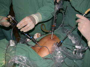 Sacrectomia total sem reconstrução – Parte II